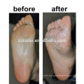 2015 hotsale OEM renewal peeling foot mask